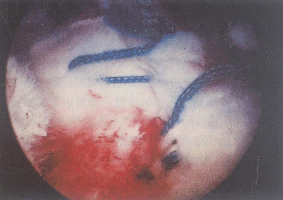 生物力學(xué)